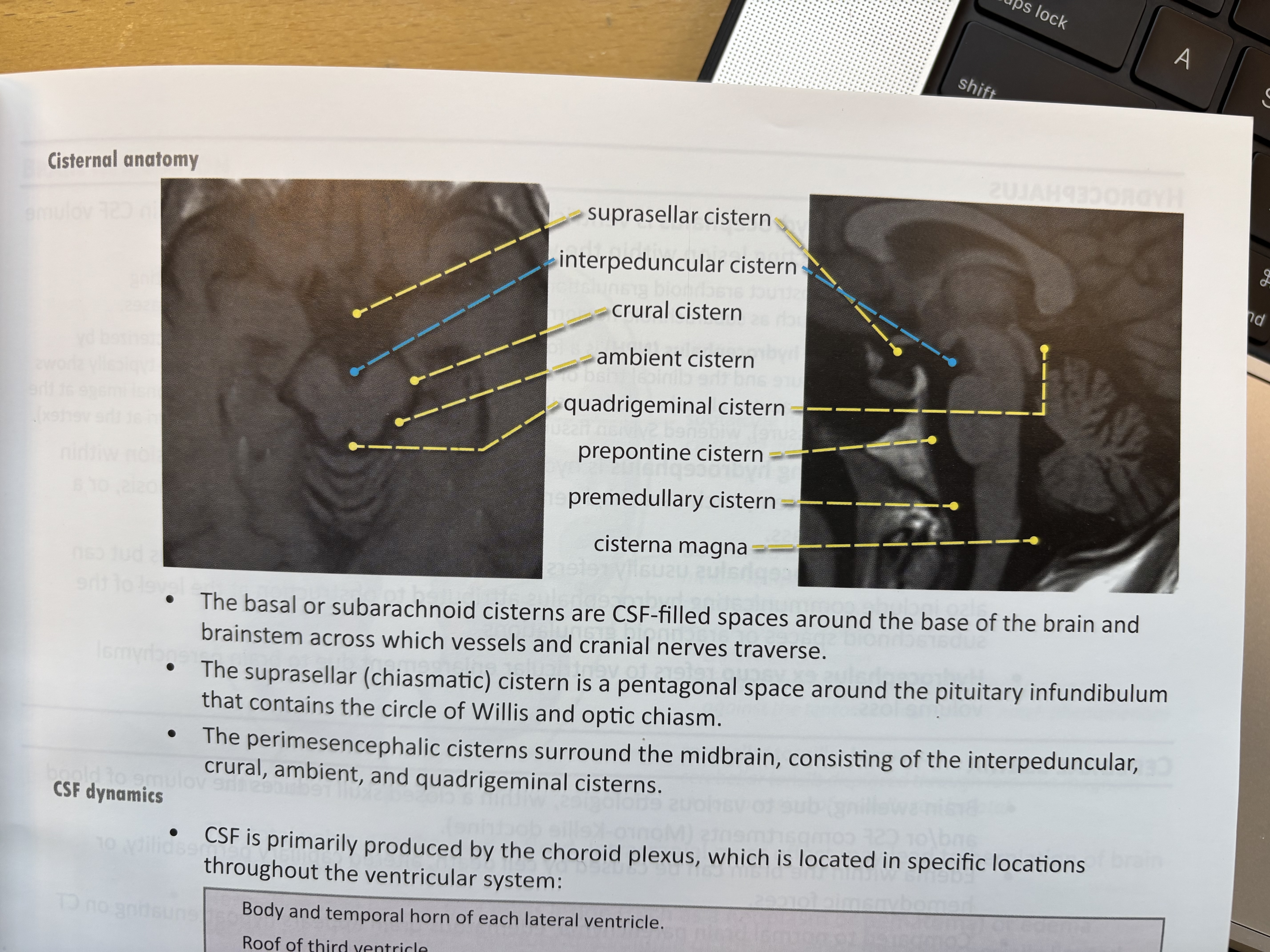 Description: Cisternal anatomy